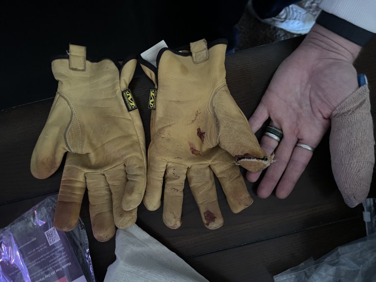 Thumb Dressed, Glove cut shown