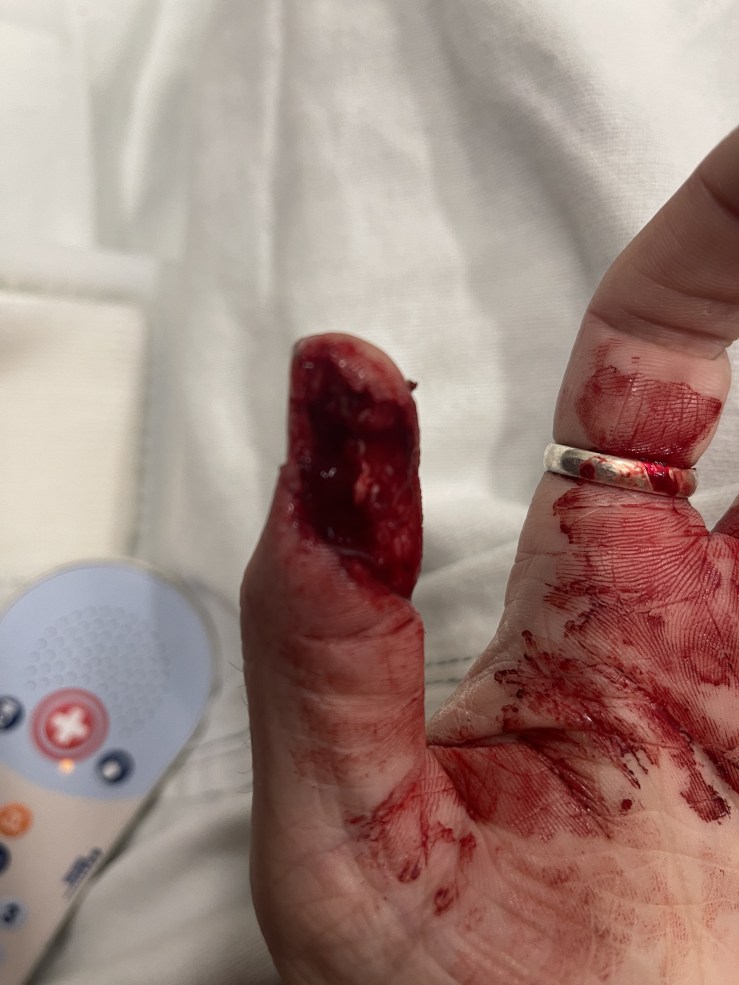 Injury in the hospital